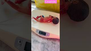 Premature baby weight 625 Gmnicu medical viralshorts [upl. by Yvon]