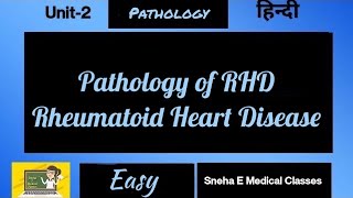 Pathology of Rheumatoid Heart Disease  RHD Pathology  Hindi [upl. by Spatz]