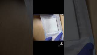 Wound Care using Iodosorb gel [upl. by Atsirak822]