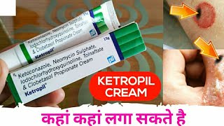 Ketoconazole Neomycin Iodochlorhydroxyquinoline Tolnaftate amp Clobetasol Propionate Cream Ketropil [upl. by Akirdnas]