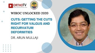 WIROC UNLOCKED 2020 Precise Cuts for Valgus and Recurvatum Deformities  Dr Arun Mullaji [upl. by Ricca]