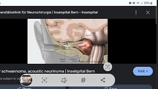 Mystery diagnosis Schwannoma [upl. by Halley]