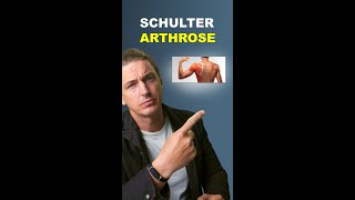 Schulter Arthrose  Omarthrose  so schaut es im Gelenk aus [upl. by Afesoj]