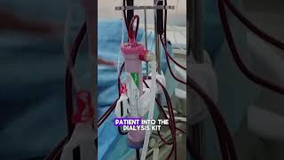 How Hemodialysis Filters Blood  Quick Overviewhemodialysis kidneydialysis dialysistreatment [upl. by Nahtanoj91]