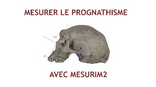 Mesurer langle facial prognathisme dans Mesurim2 [upl. by Araihc]