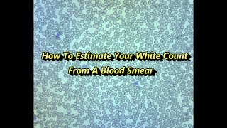 How to Estimate your White Blood Cell Count from a Blood Smear [upl. by Leirad]