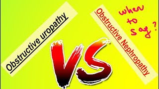 OBSTRUCTIVE UROPATHY amp OBSTRUCTIVE NEPHROPATHY  DM TOPICS  VIDEO 220 [upl. by Aihcropal]