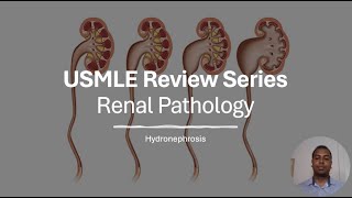 USMLE Review Series  Renal Pathology  Hydronephrosis [upl. by Ylatan782]