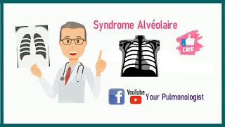 Série Radio  Syndrome alvéolaire de A à Z [upl. by Adnirod]