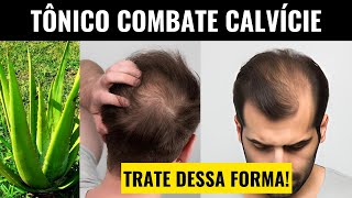 TÔNICO PODEROSO PARA TRATAR ALOPECIA ANDROGENÉTICA [upl. by Nevet803]