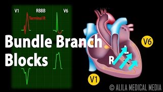 Bundle Branch Block Animation [upl. by Iridis]