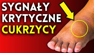 9 wskaźników cukrzycy które często są ignorowane [upl. by Recor256]