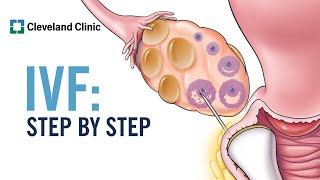 How Does In Vitro Fertilization IVF Work A StepbyStep Explanation [upl. by Hicks151]