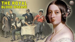 All About Hemophilia The Royal Blood Disease [upl. by Esyla]