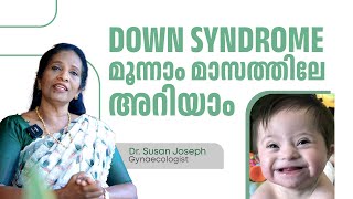 Down syndrome മൂന്നാം മാസത്തിലേ അറിയാം  Dr Susan Joseph [upl. by Nnylrats]