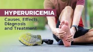 hyperuricemia and its Treatment Gout hyperuricaemia treatment drbadarkhan kneeepain jonpain [upl. by Alletniuq]