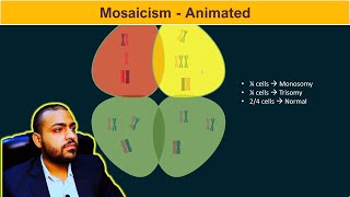 Mosaicism Basic Concepts [upl. by Wina356]