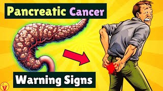 10 Warning Signs of PANCREATIC CANCER That Will SHOCK You  VisitJoy [upl. by Darum]