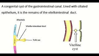 Embryology of vitellointestinal duct  formation fate amp congenital anomalies [upl. by Drews]