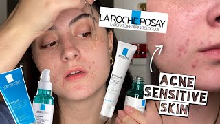 TESTING LA ROCHE POSAY EFFECLAR SKINCARE ROUTINE ON ACNE SENSITIVE DRY SKIN FOR 2 WEEKS [upl. by Nomsed]