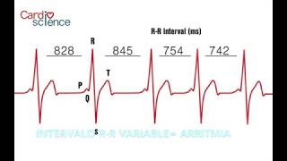 MODULO 6 CALCULO DE LA FRECUENCIA CARDIACA [upl. by Trebleda]