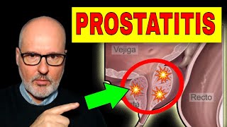 PROSTATITIS AGUDA y CRÓNICA Síntomas Causas y Tratamiento [upl. by Laurianne]