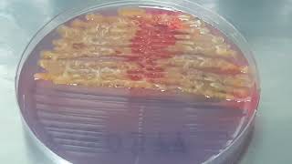 Serratia fonticola on CLED Agar Uropathogen [upl. by Asiuqram]