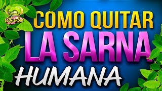 Como Curar La Sarna Humana De Una Forma Rápida Y Eficaz [upl. by Yenattirb]