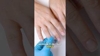 Nail Extension Gone Wrong  Remedy for Post Nail Care Treatment  Dr Nitika Kohli [upl. by Ecargyram]