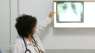 Dr Vera Lleshi Pneumonia Recidivande e shpeshtë te pacientët shkak Covid19 [upl. by Mines151]