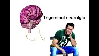 Trigeminal neuralgia  Nerve origin course and supply [upl. by Souvaine]