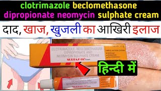 clotrimazole beclomethasone dipropionate neomycin sulphate cream uses in hindi  surfaz sn cream [upl. by Mihalco]