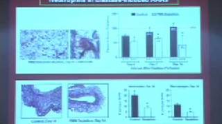 AAA Insights from the ElastaseInduced Rodent Model [upl. by Pinchas]