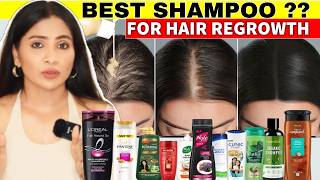 I used this👆🏼trick to treat hair thinning Got Full Hair Growth in 1 MonthThick Dense Hair Shampoo [upl. by Ydnik]