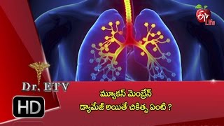 Dr ETV  Damaged mucous membrane nose  19th January 2017  డాక్టర్ ఈటివీ [upl. by Massie]