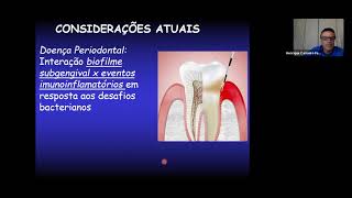 PATOGÊNESE PERIODONTAL [upl. by Diogenes64]