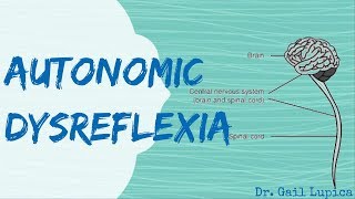 Autonomic Dysreflexia for Nursing Students [upl. by Etireuqram]