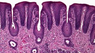 Circumvallate papillae  practical Histology [upl. by Weaks]