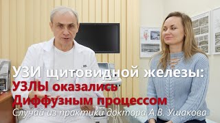 Лечение щитовидки корой усохшей вишни Зоб Как лечить щитовидную железу в домашних условиях [upl. by Nicolai]