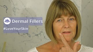 What can you expect from dermal filler treatment [upl. by Ael]