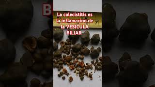 La colecistitis es la inflamacion de la VESICULA BILIAR [upl. by Demahum671]