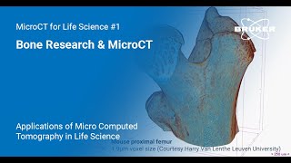 Bone Research amp MicroCT  Applications of MicroCT in Life Science 1 [upl. by Kalman378]