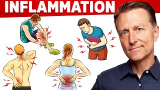 The 1 Best Remedy for Inflammation Autoimmune Gut and Arthritis That You Never Considered [upl. by Inverson14]