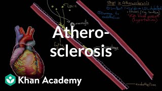 Atherosclerosis  Circulatory System and Disease  NCLEXRN  Khan Academy [upl. by Ireva]