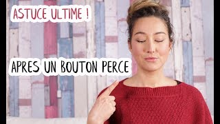 2 produits INCONTOURNABLES pour faire CICATRISER son BOUTON après l’avoir percé [upl. by Llerdna]