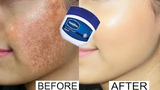 Vaseline for face pigmentation overnight  Vaseline on face at night benefits  Vaseline on face [upl. by Dnaletak44]