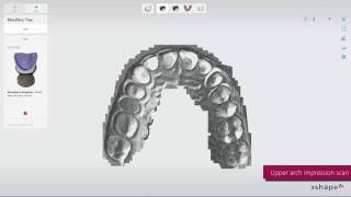 3Shape impression scanning [upl. by Rehc811]