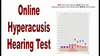 Hyperacusis Online Hearing Test Lowest Discomfort Level or LDL [upl. by Aniram]