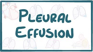 Pleural Effusion  causes symptoms diagnosis treatment pathology [upl. by Adolpho]