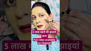 Pigmentation treatment at home raw milk [upl. by Makell]